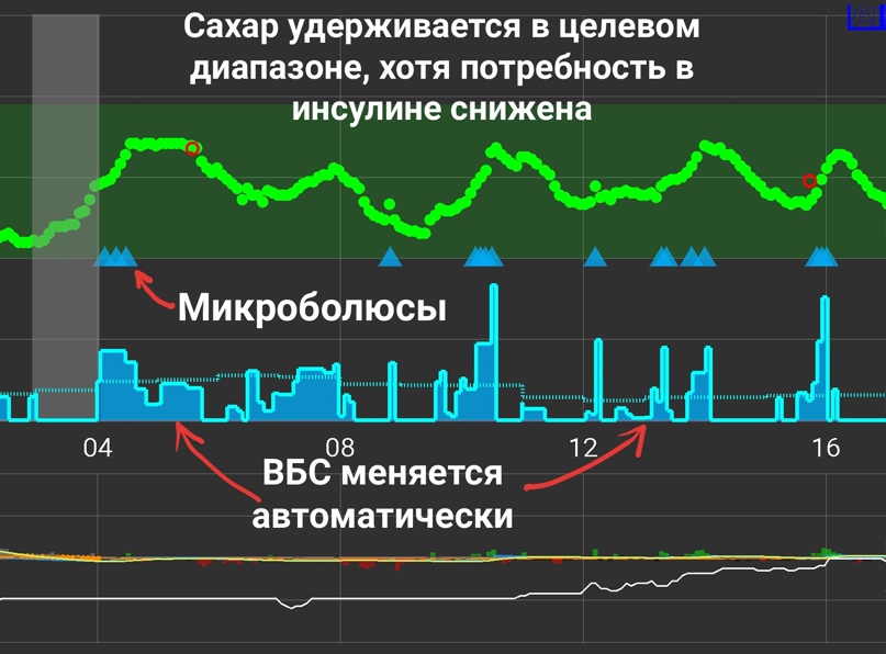 График сахара, удерживающийся в диапазоне от 4 до 8 ммоль/л за счет
постоянного изменения ВБС и введения микроболюсов.